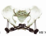 orthopedic appliances such as surgical instrument - orthopedic appliance